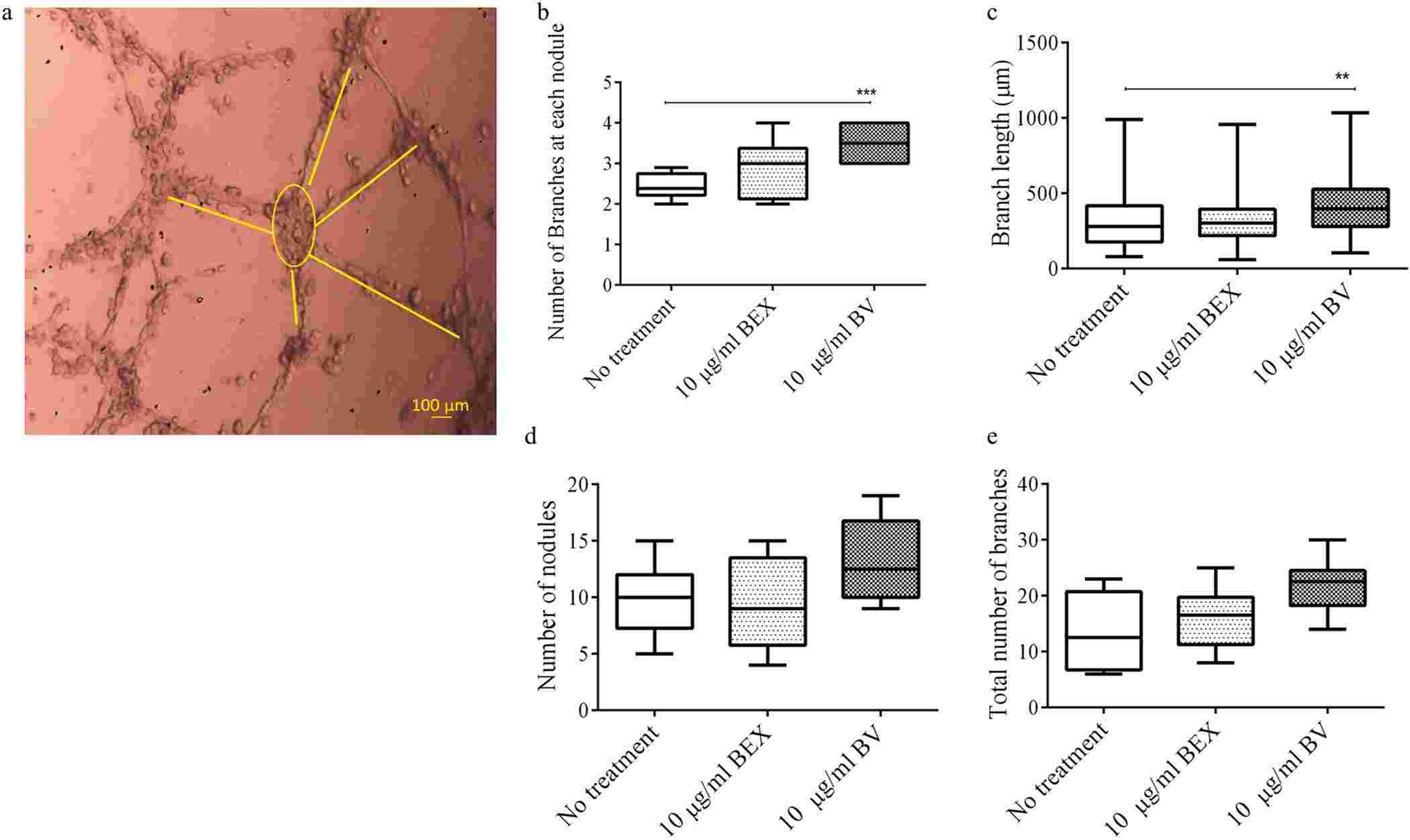 Angiogenic effects of beet-derived exosomes.